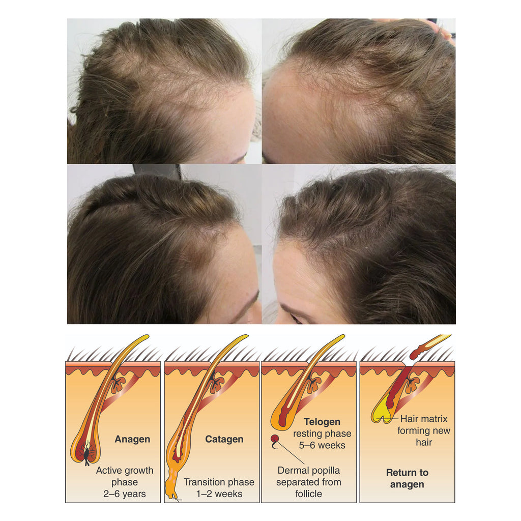 South Moon Rice Shampoo Soap Hair Growth Anti-hair Loss Nourishing Hair Strengthening Deep Cleansing