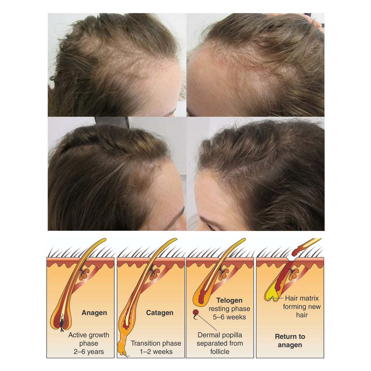 South Moon Rice Shampoo Soap Hair Growth Anti-hair Loss Nourishing Hair Strengthening Deep Cleansing