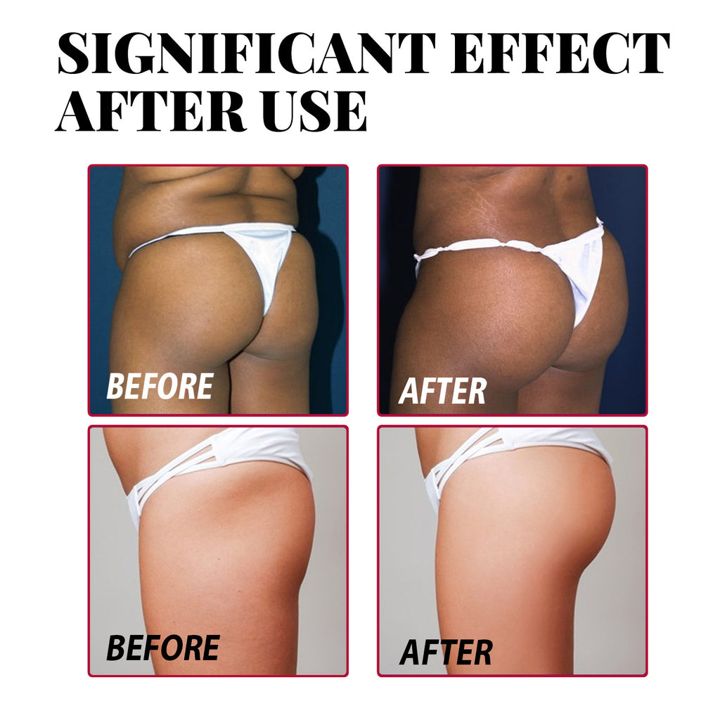West&Month Plump Buttock Cream Lifts And Tightens Buttocks