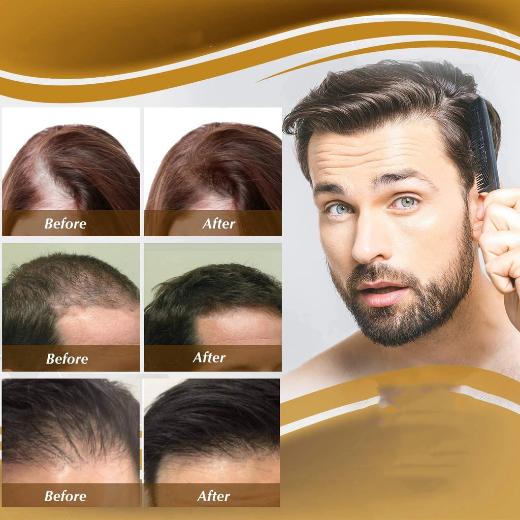 iBeaLee Anti Hair Care Hair Nourishing Liquid Hair Firming And Hair Increasing