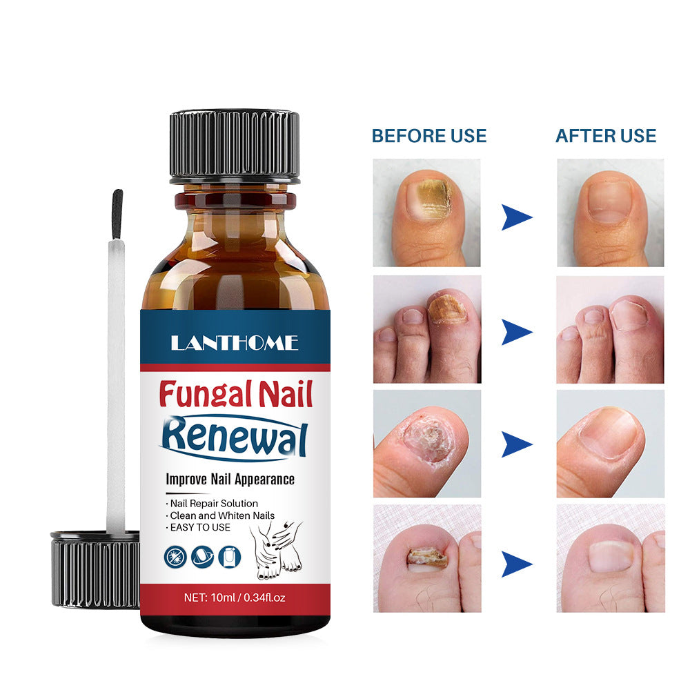 Lanthome Nail Liquid Mildly Moisturizing Nail Nourishing Liquid