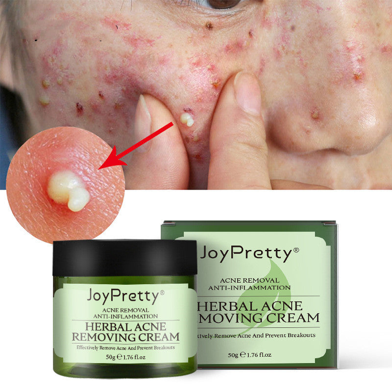 JayPretty Herbal Blemish Cream For Reducing Blemish Marks