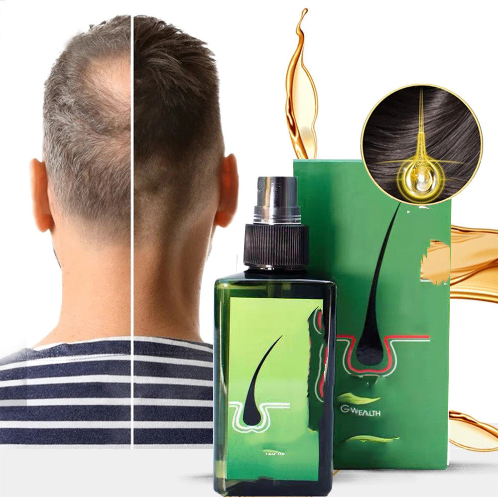 Neo Hair Lotion Removing Dandruff, Nourishinging And Nourishing Shampoo