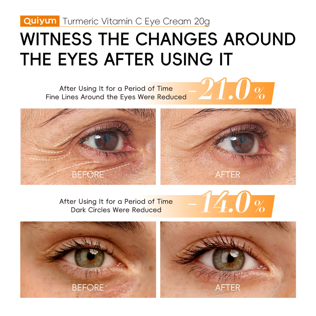 Quiyum Turmeric Vitamin C Eye Cream 15g Moisturizing