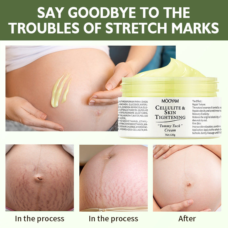 Mooyam Stretch Mark Cream Fat Body Pattern Recovery Cream