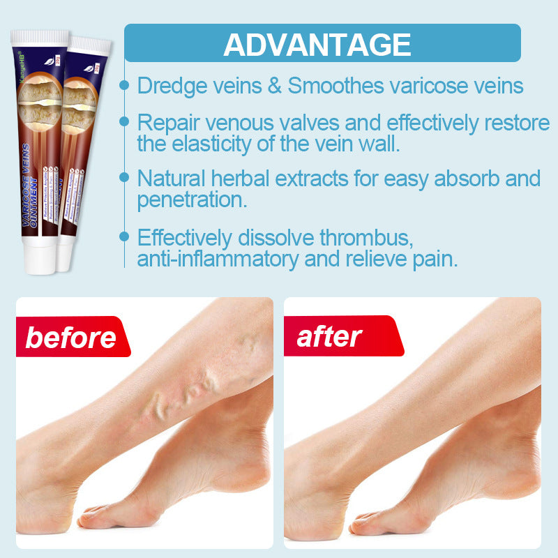 KangyeHB Maikang Earthworm Leg Pulse Tube Cream
