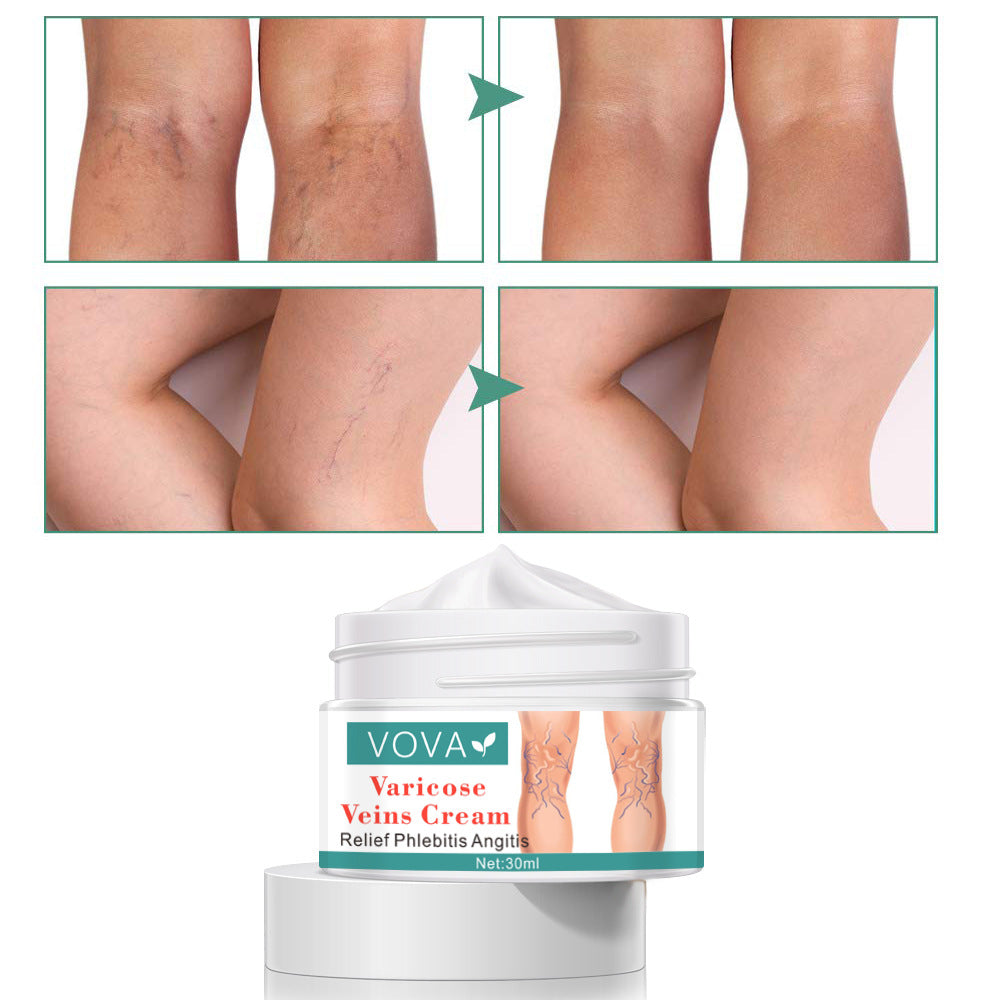 Vova Spider Leg Varicose Vein Nourishing Cream