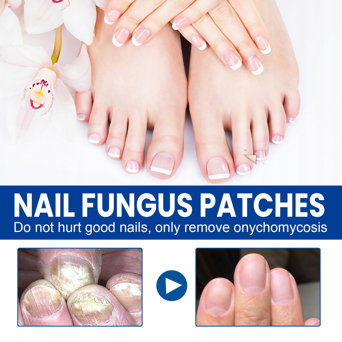 Ximonth Nail Nursing Adhesive Bandage Nourishing