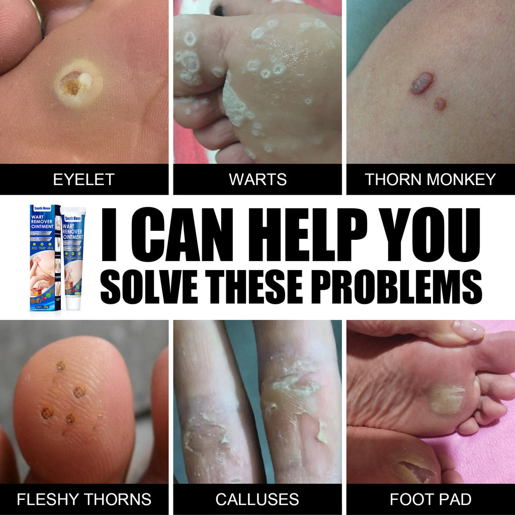 Hand Foot Face Underarm Skin Removing Cream