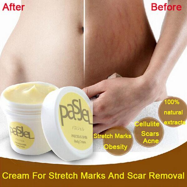 Pastel car Removal and Stretch Mark Cream