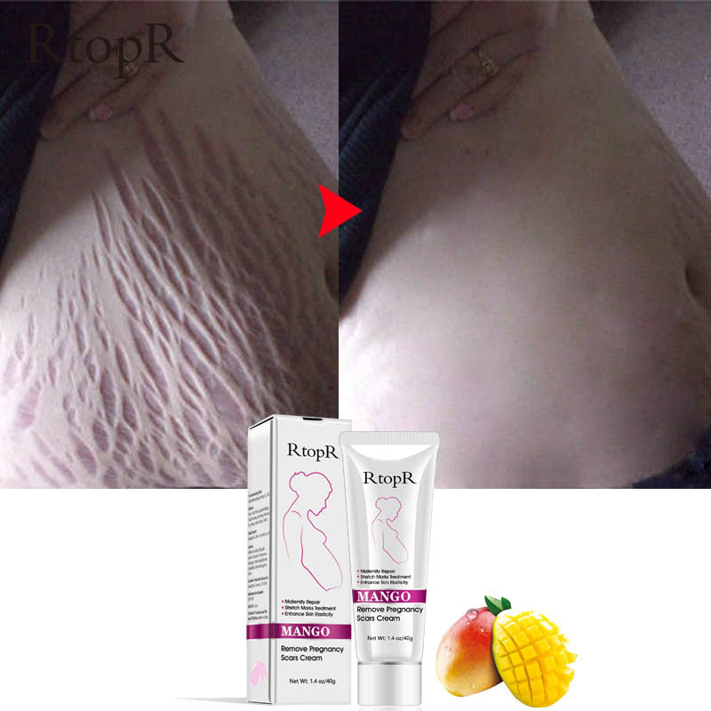 RtopR Mango Anti-Pregnancy Cream