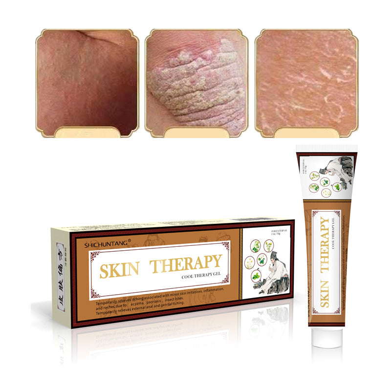 Shichuntang Psoriasis Cream Skin Skin care lotion For External Use 15g Herbal Cream