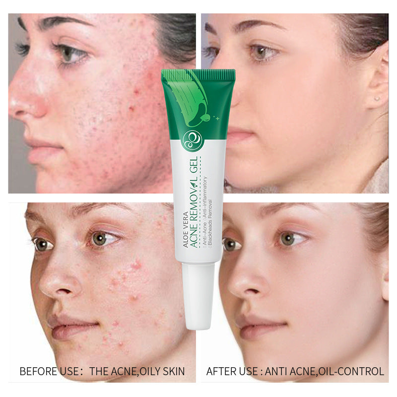 Aloe Vera Blemish Care Gel Face Cream Serum Clear Skin Skin Mark Cream Shrink Pores Moisturizing Oil Control Soothing Skin Care