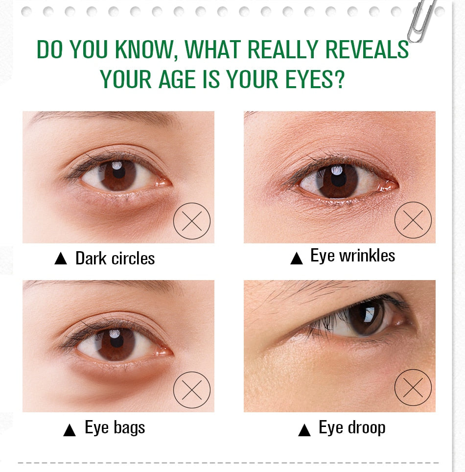 Alove Vera 1 Anti Dark Circle Eye Cream
