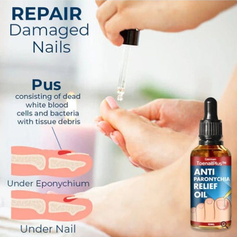 ToenailPlus Bright Nail Nourishing Thickened Nail Groove Care Oil