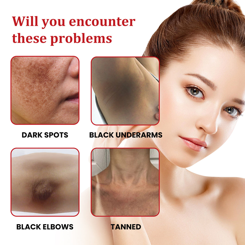 Ouhoe Black Spot Nourishing Cream Fading Wrinkle