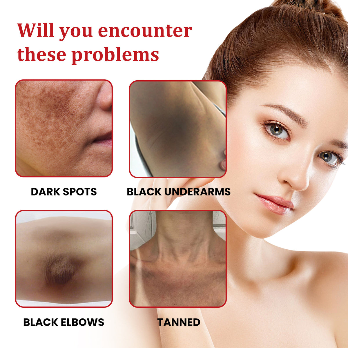 Ouhoe Black Spot Nourishing Cream Fading Wrinkle