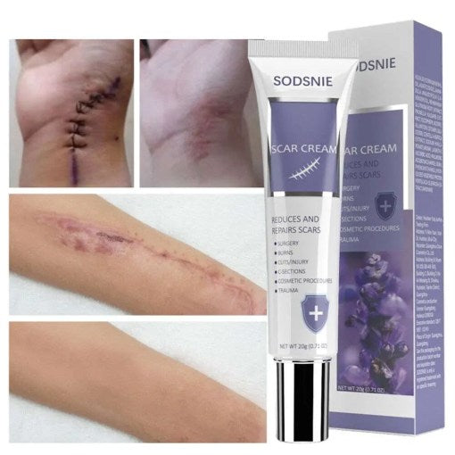 Sodsine Advanced Skin Mark Cream 20G