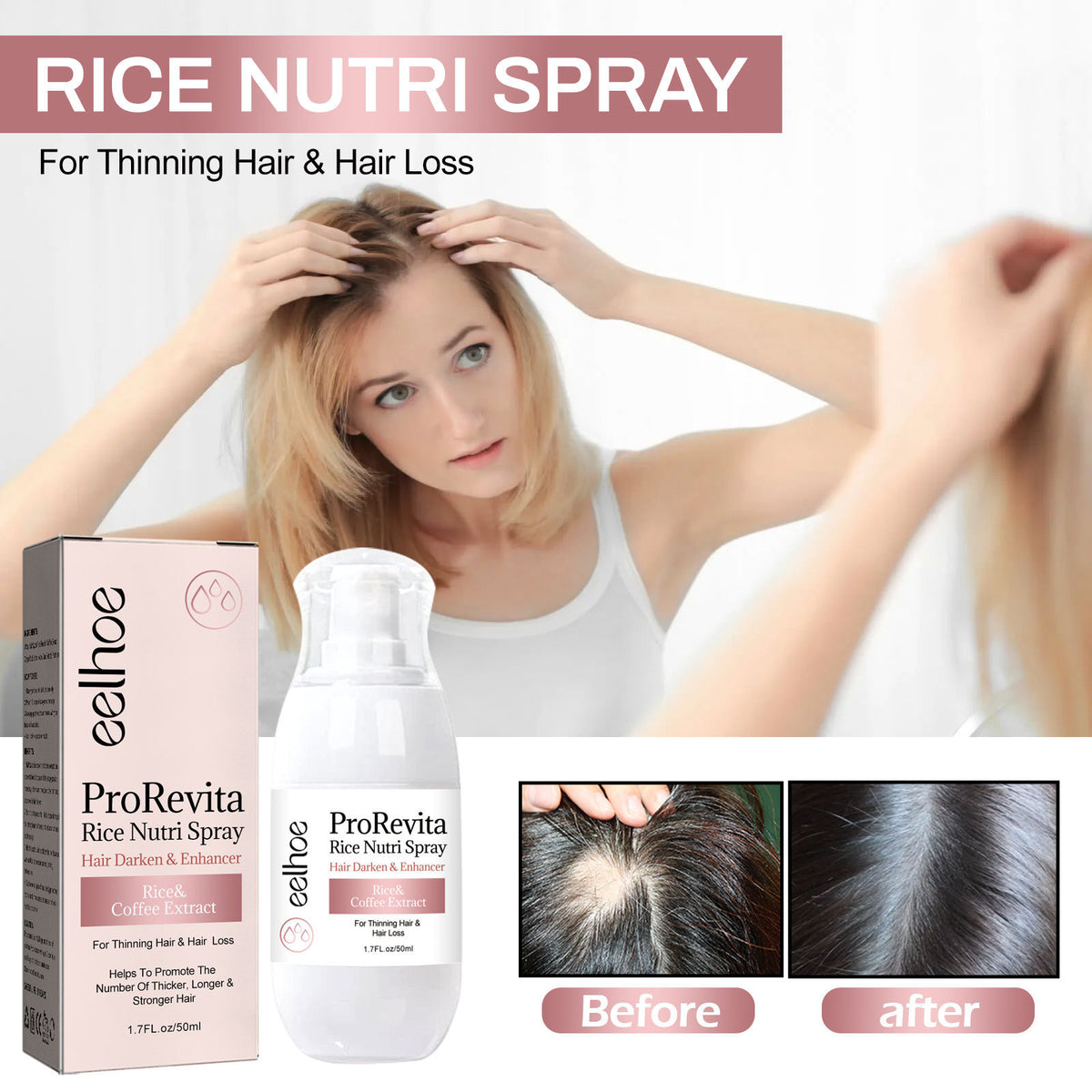 Eelhoe Strong Nourishing Rice Dense Hair Spray Hair Follicle Hair Root Anti-drop