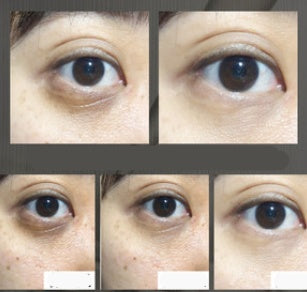 Venom Peptide Anti wrinkle eye cream