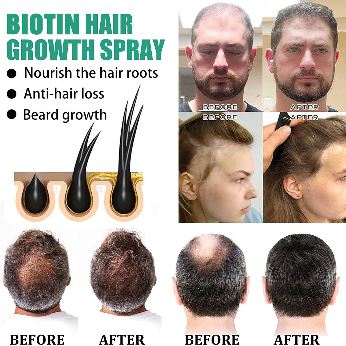 iBeaLee Anti Hair Care Hair Nourishing Liquid Hair Firming And Hair Increasing