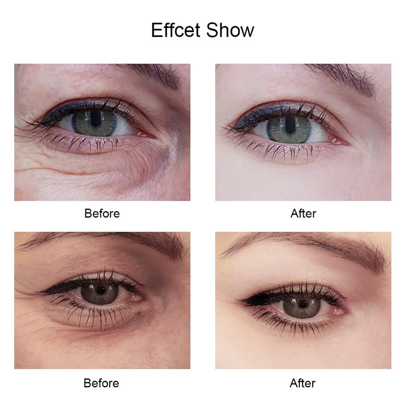 Veze Moisturizing Eye Cream Improves Dark Circles