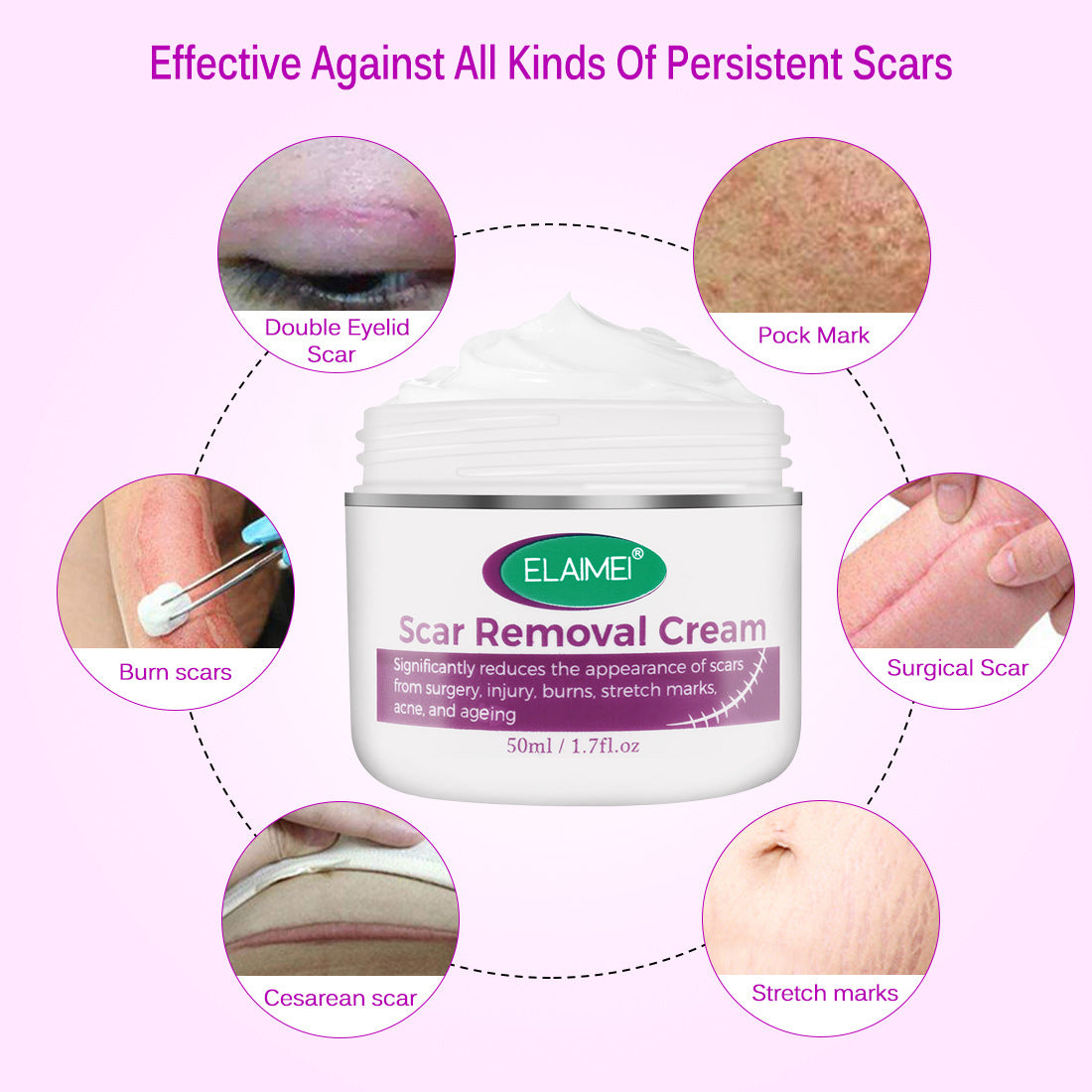 Elaimei Skin Rebound Scarless Cream Scar Removal Cream Face Cream For Face Acne Scar Stretch Marks Skin Repair Face Cream