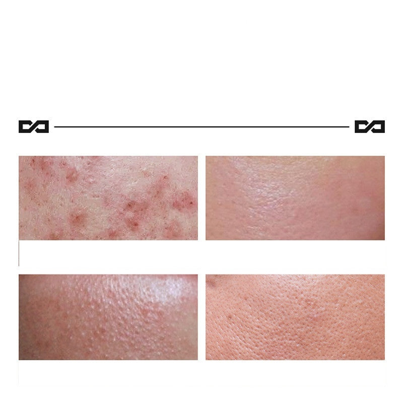 Herbal Lightening Blemish Cream Skin Care
