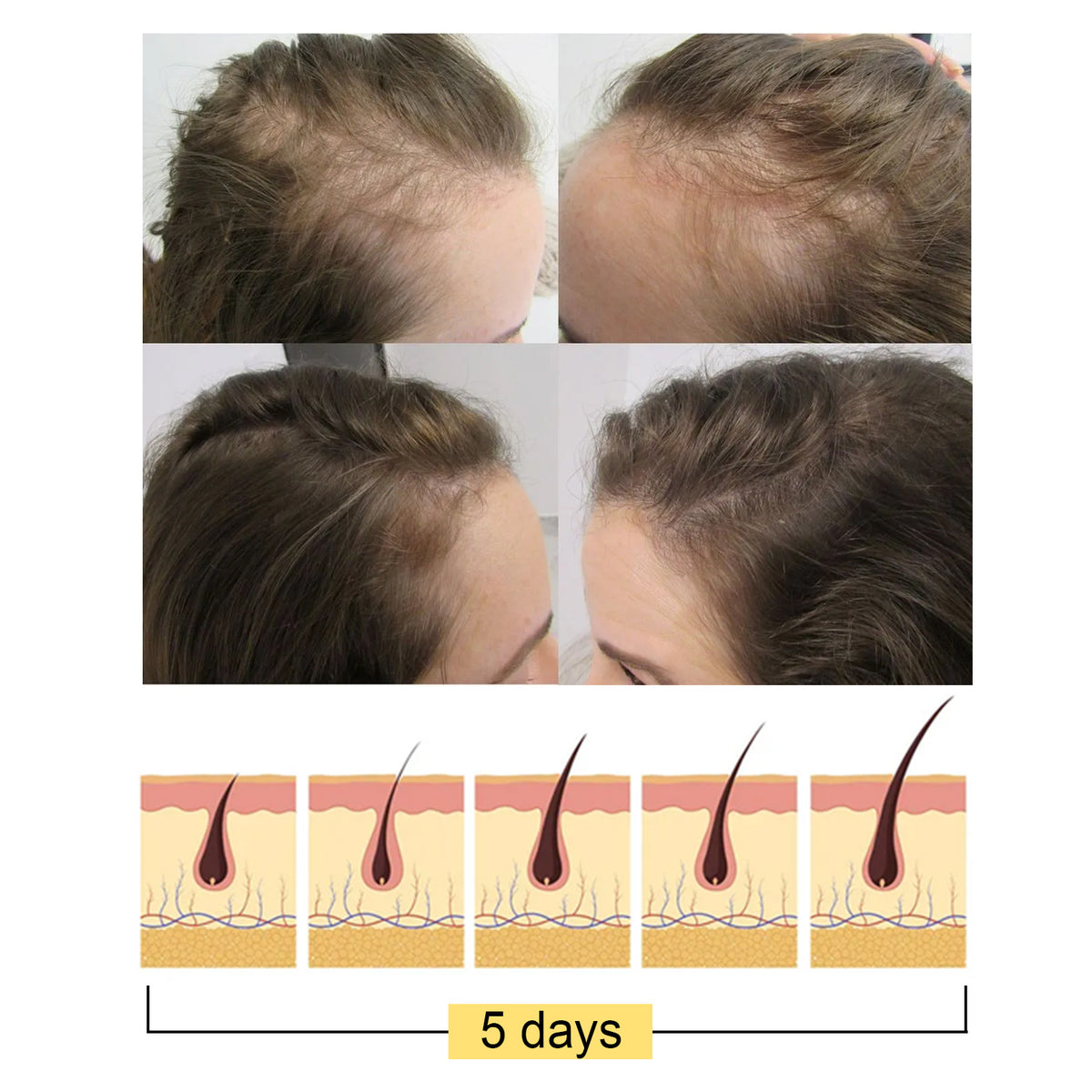 Jaysuing Rice Shampoo Soap Moisturizing Conditioning Hair Growth