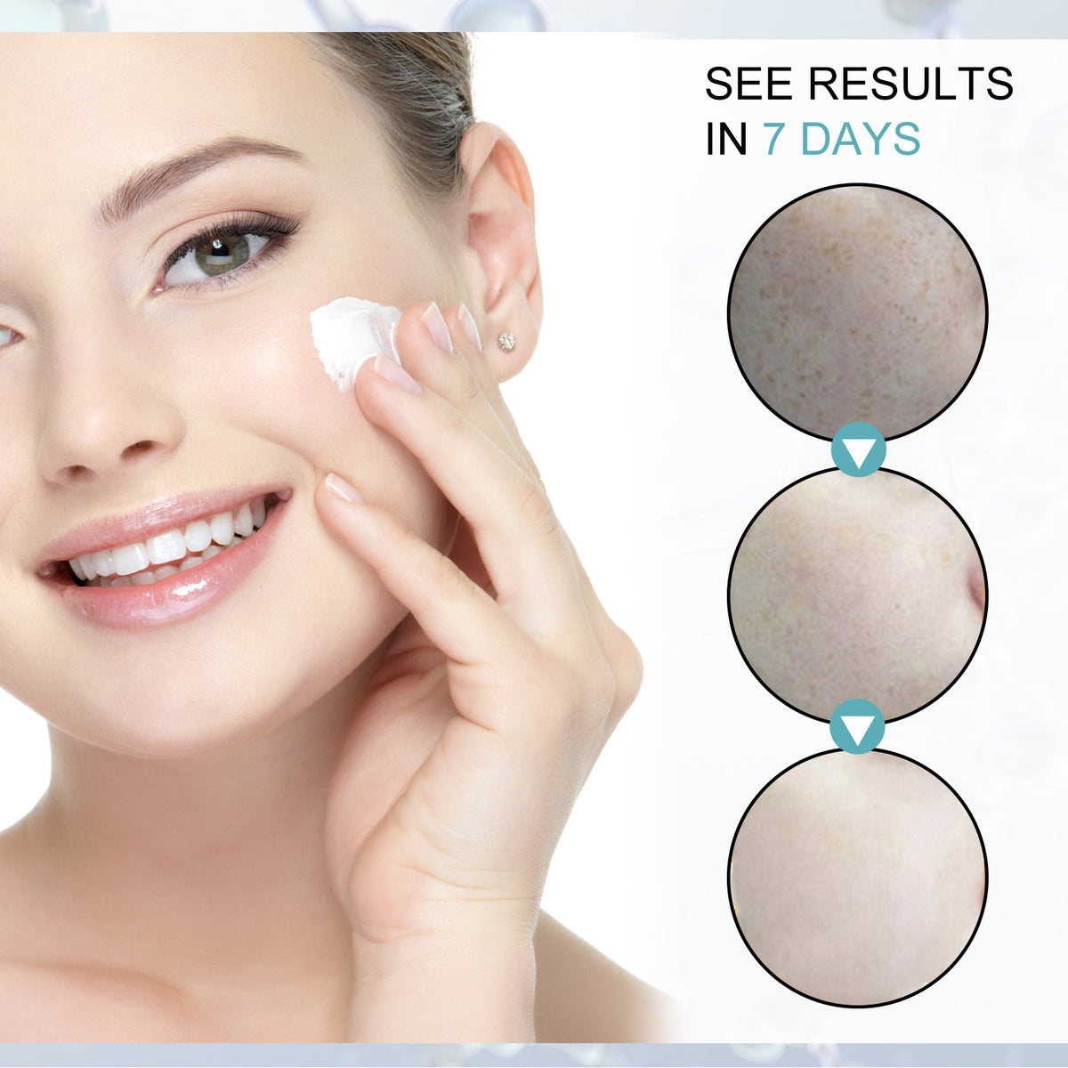 Eelhoe Facial Moisturizing Blackspot Removing Cream