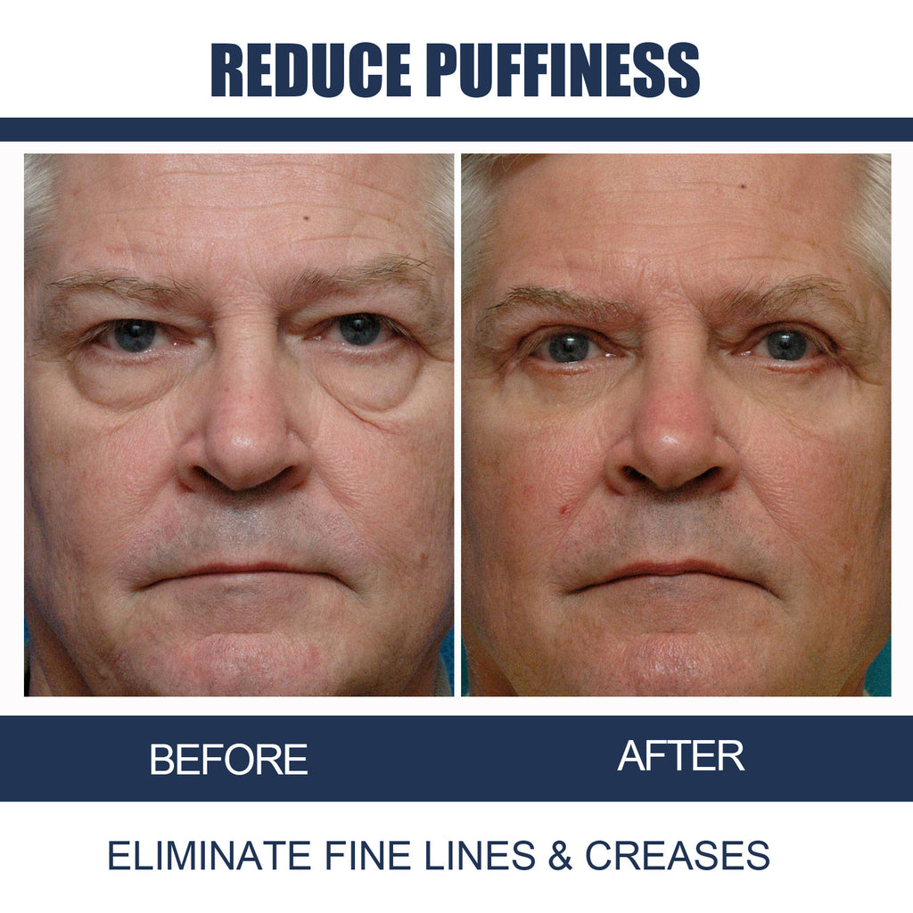 Openeyes Men's Anti-aging Eye Cream