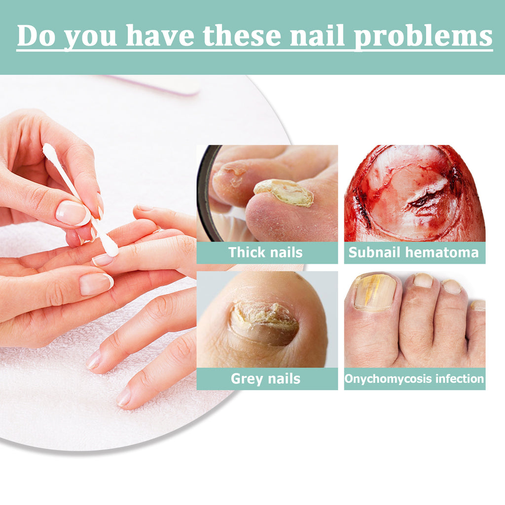 Nail Nourishing Pen Nail Removal Dead Skin Barbed Moisturizing Nourishing Pen