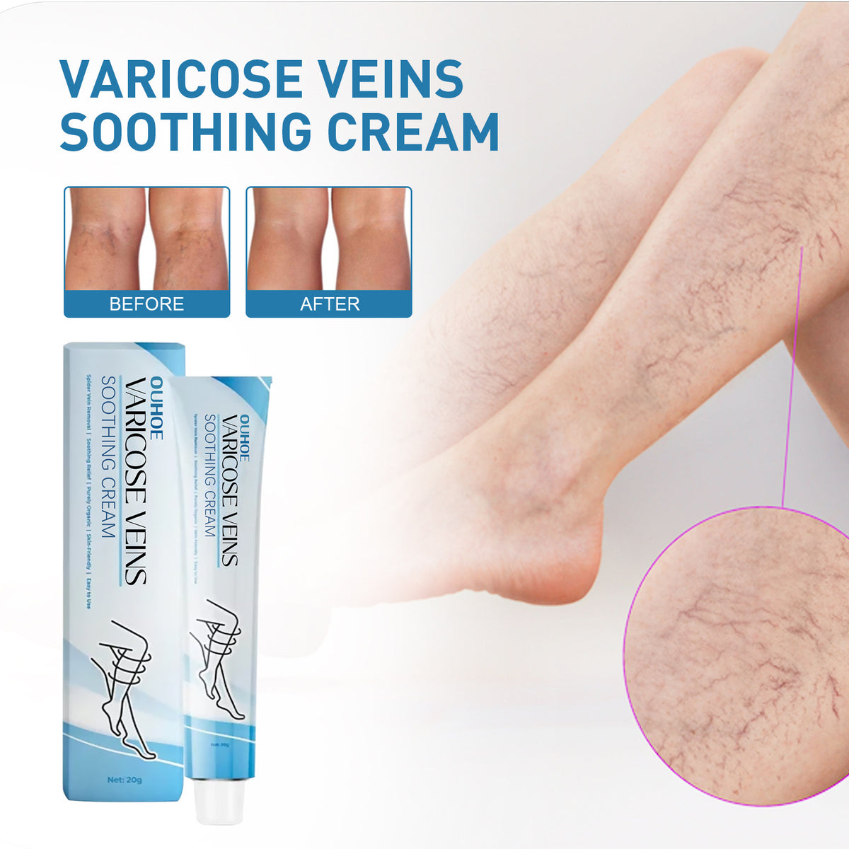 Ouhoe Intravenous Nourishing Cream Relieve Leg Leg Massage Soreness Maikang Neck Cream