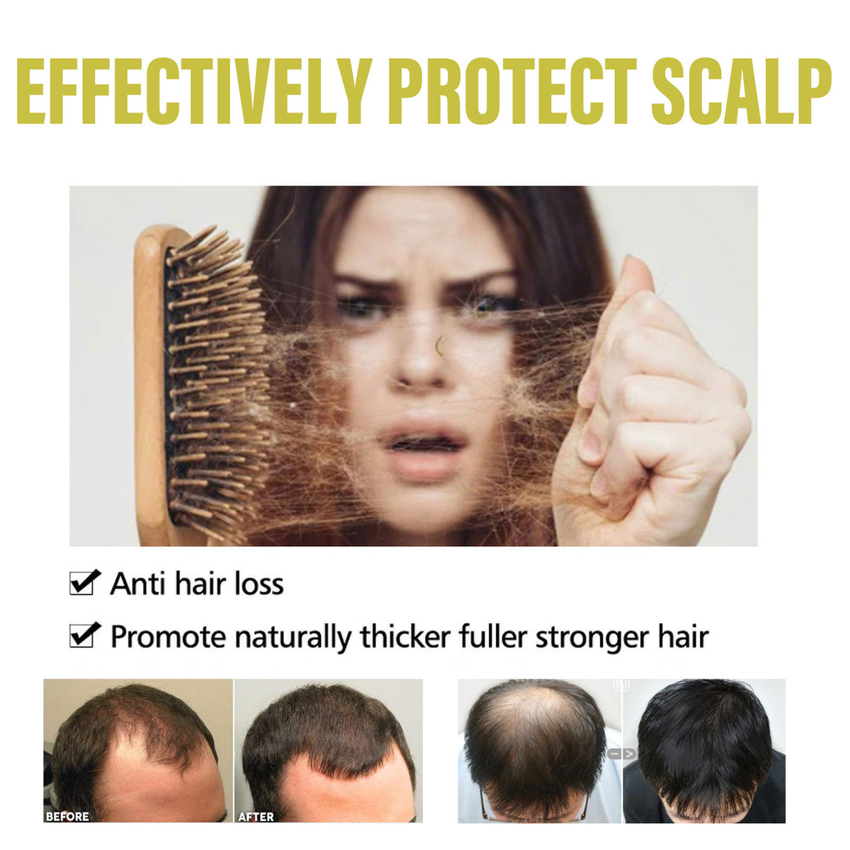 Ouhoe Ginger Dense Hair Shampoo For Relieving Soothinging