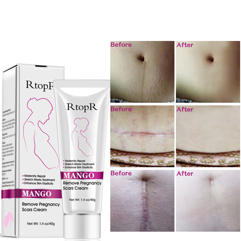RtopR Mango Anti-Pregnancy Cream
