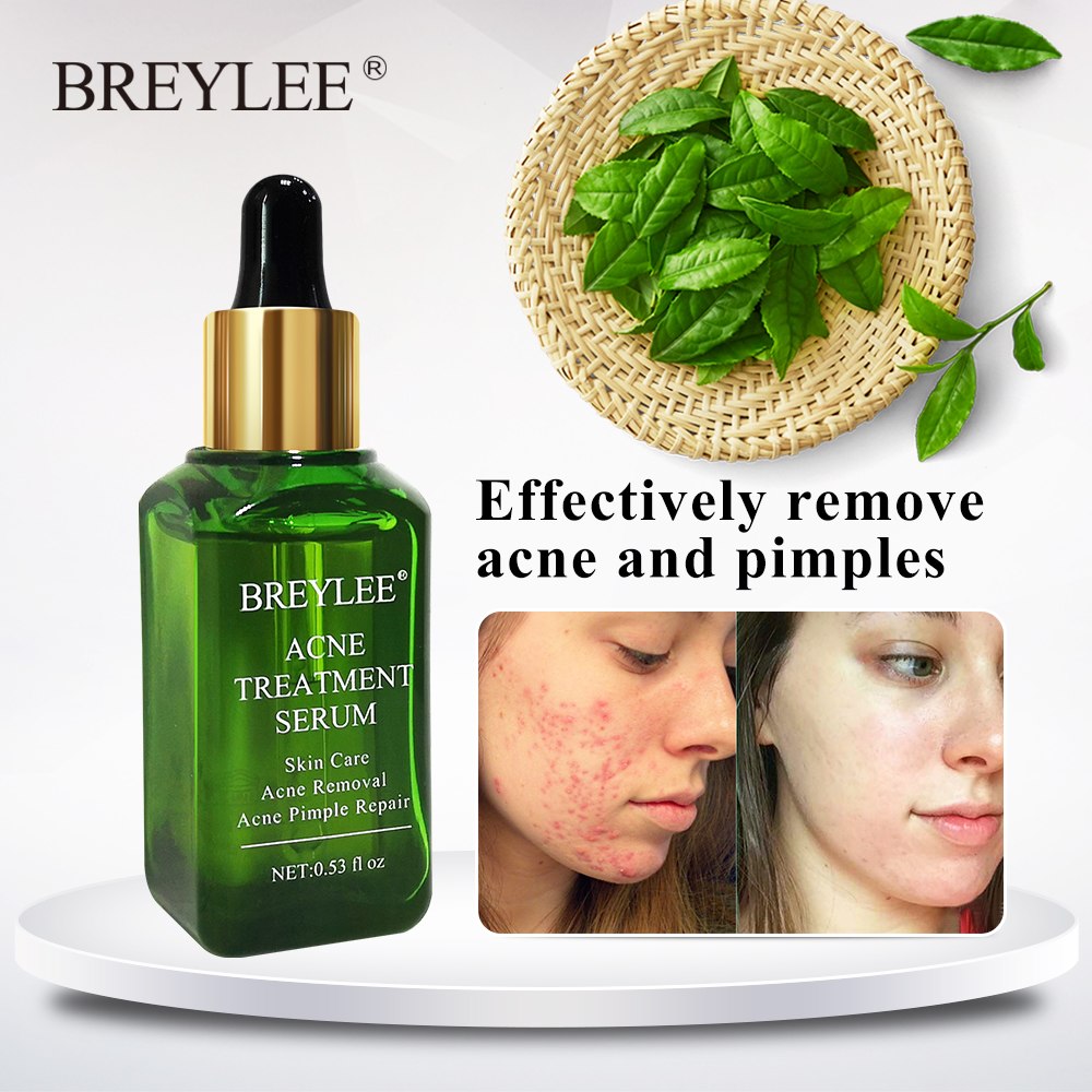 BREYLEE Blemish Care Serum Face Facial Clear Skin Skin Smoothing Cream Skin Care Brightening Nourishing Pimple Remover For Blemish