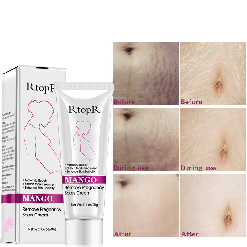 RtopR Mango Anti-Pregnancy Cream
