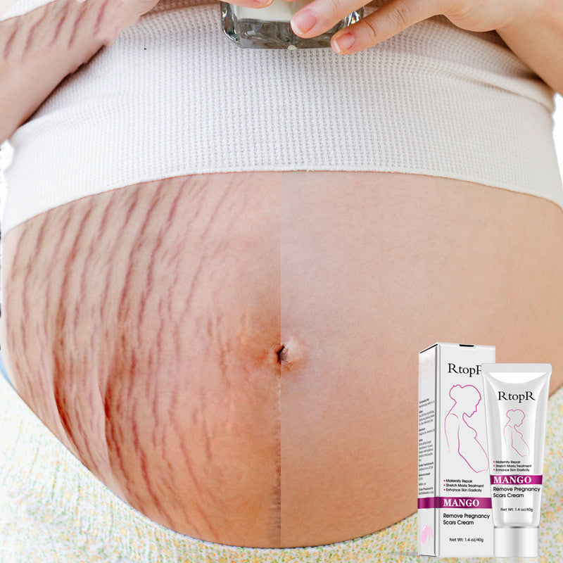 RtopR Mango Anti-Pregnancy Cream