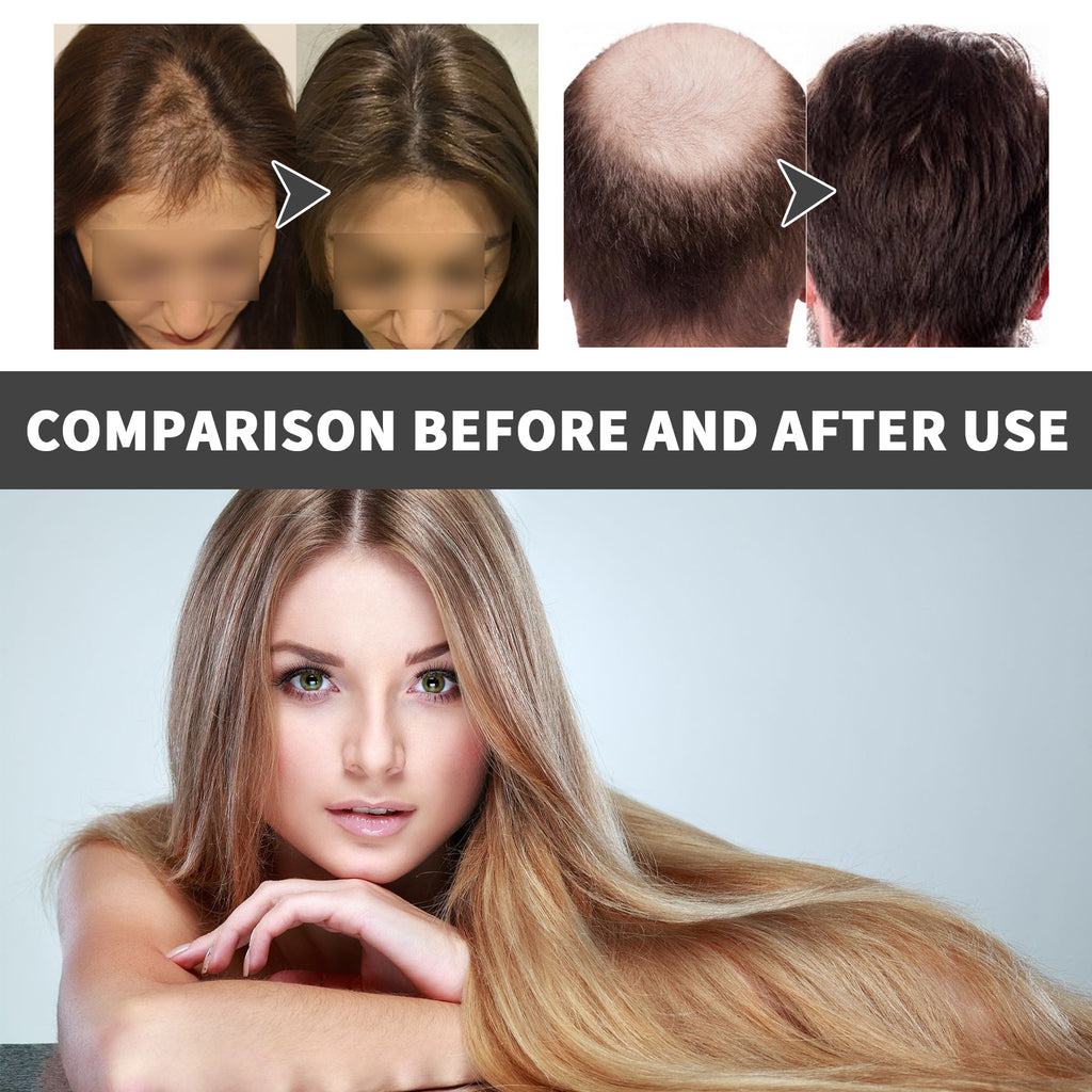 HoeGoa Hair Care Oil Improves Hair Dryness And Frizz