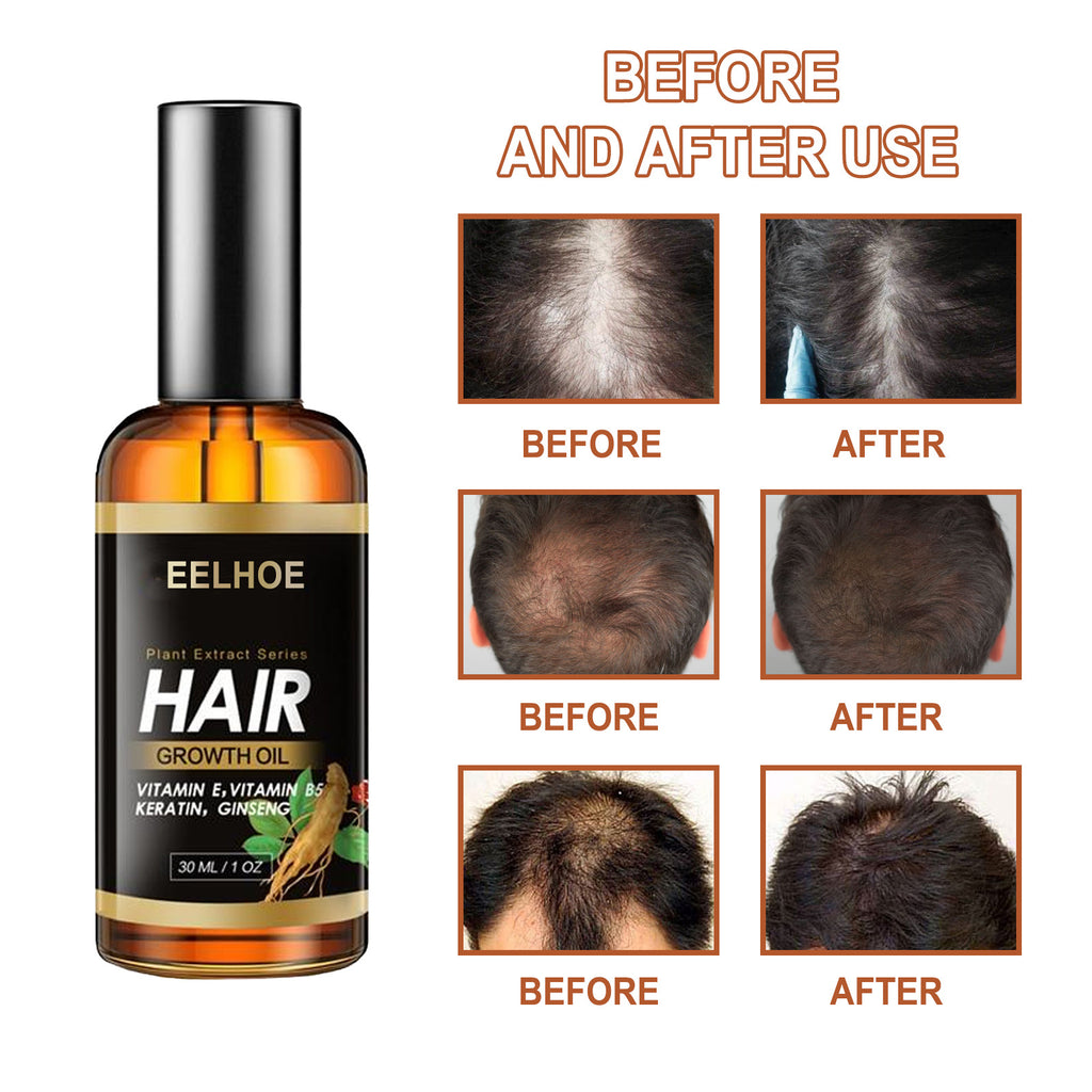 EELHOE Herb Hair Hairdressing Hair Care Essential Oil Hair Strong Hair Reduce Hair Care Broken Hair Hair Care Essential Oil