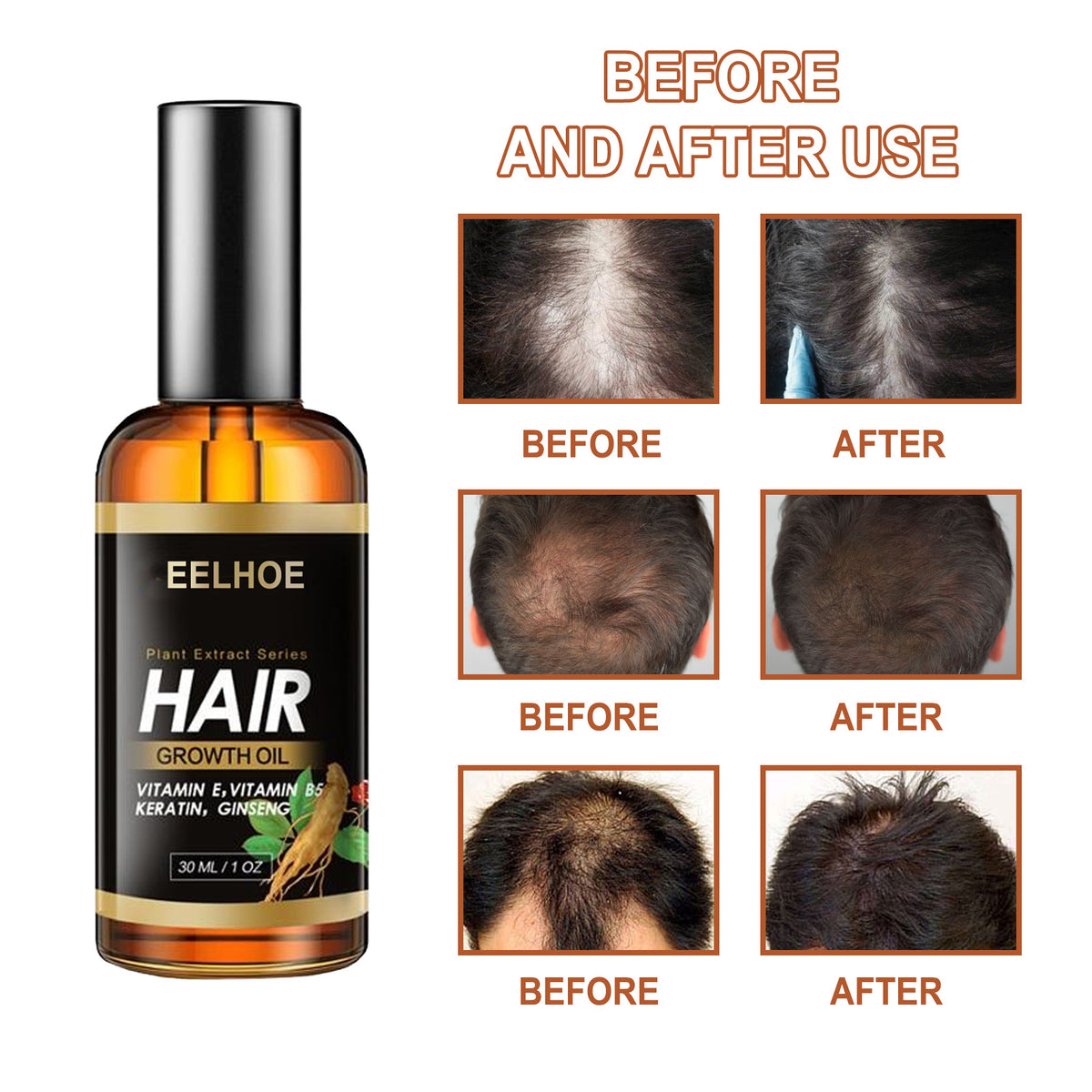 EELHOE Herb Hair Hairdressing Hair Care Essential Oil Hair Strong Hair Reduce Hair Care Broken Hair Hair Care Essential Oil