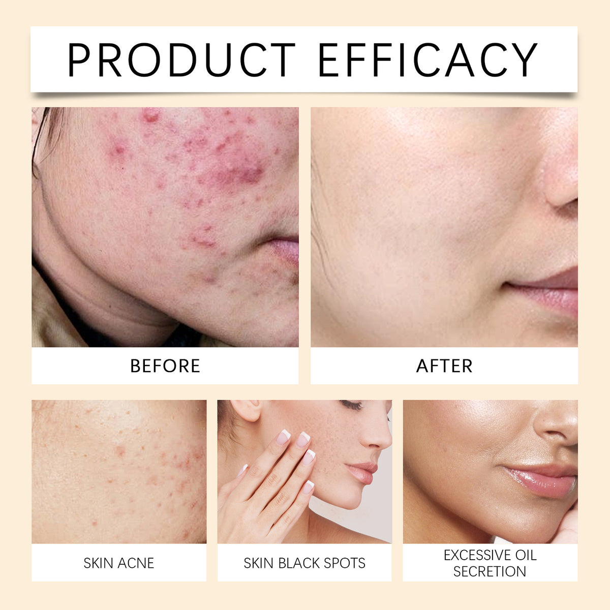 Hoygi Lighten Blemish Mark And Moisturize Face Cream