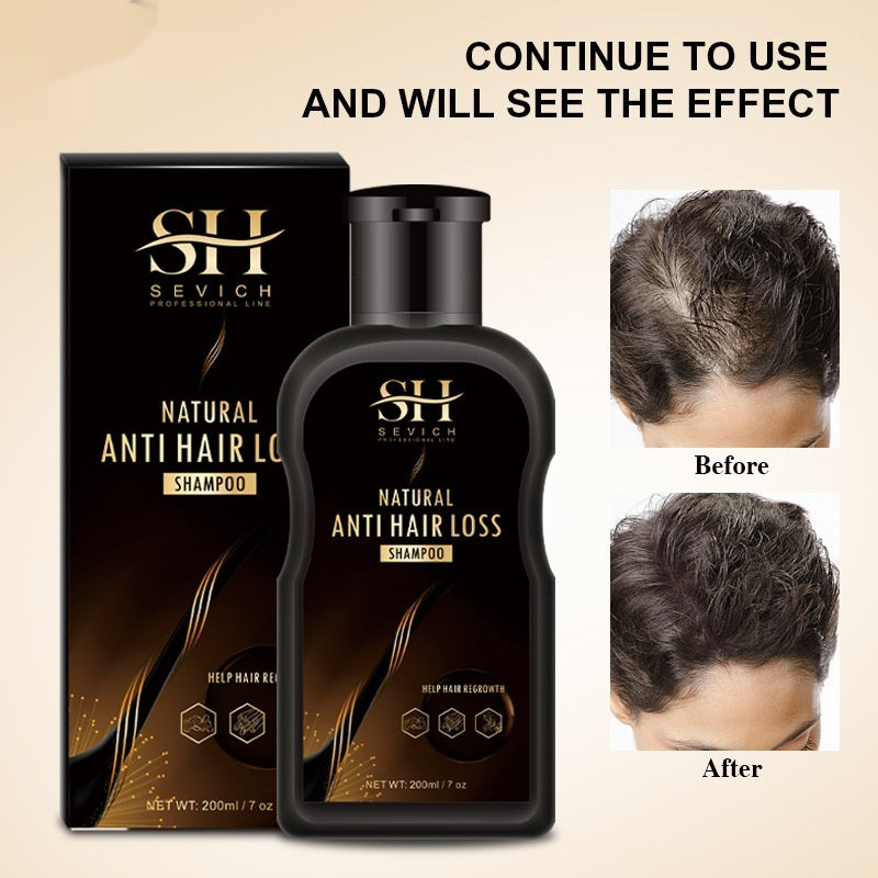 Sevich Ginger Anti-hair Loss Anti-dandruff Anti-hair Loss Dense Hair Care Hair Plant Ginger Shampoo