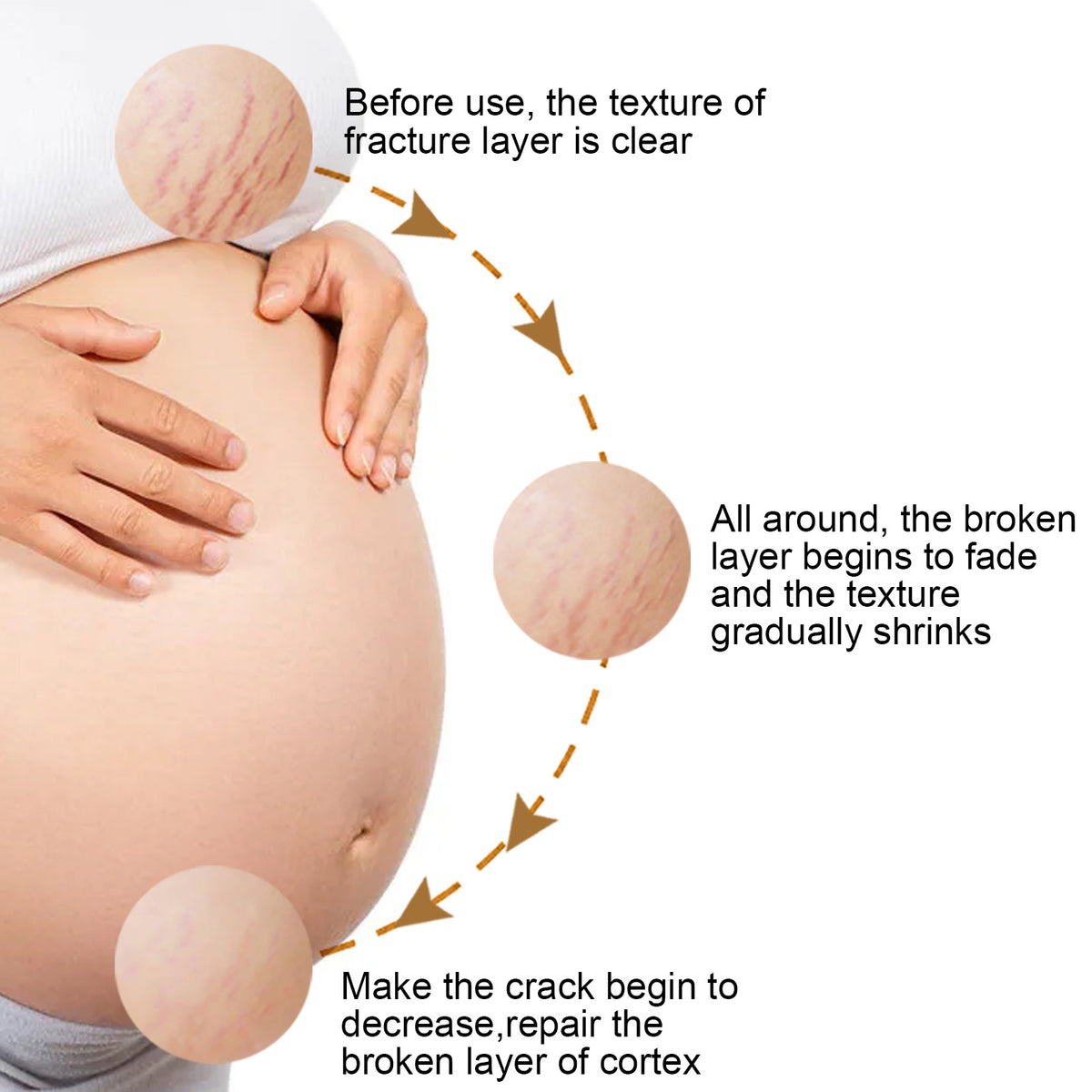 Eelhoe Fade Prevention Of Obesity Pregnancy Nourishing Cream