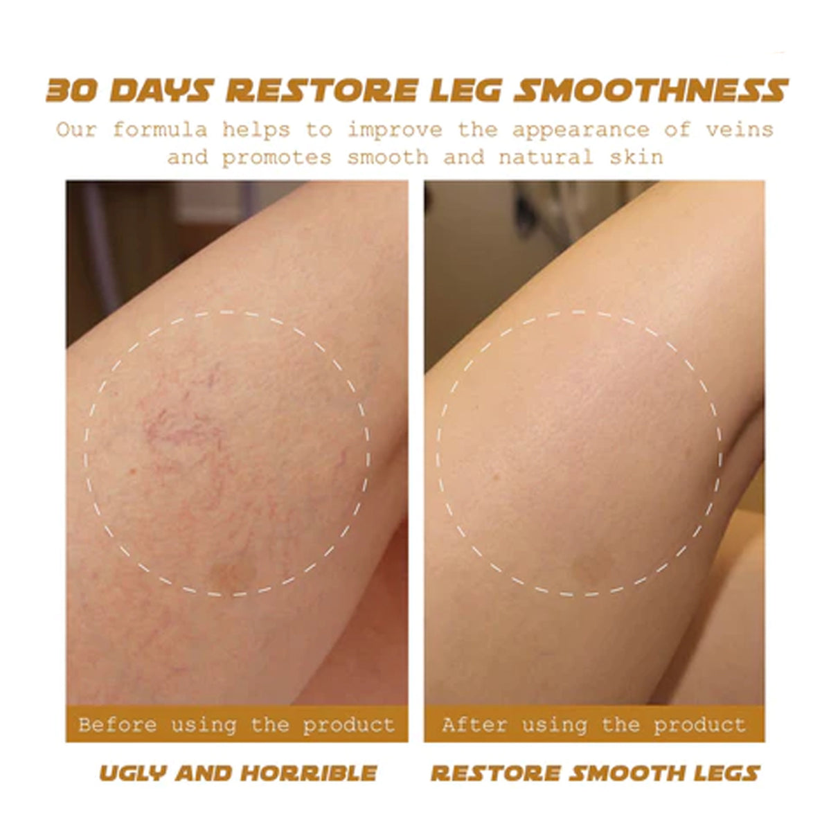 Ximonth Venous Massage Cream To Soothe Sore Legs