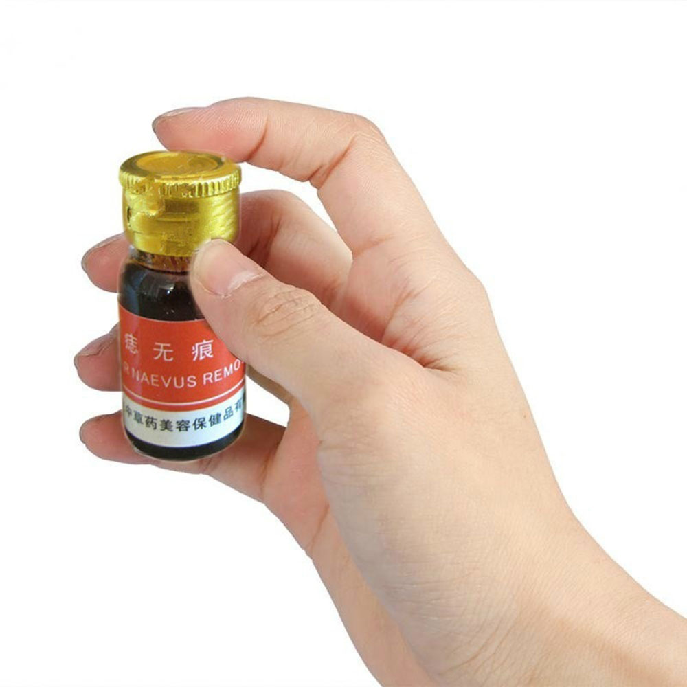 Naevus Mole removal cream
