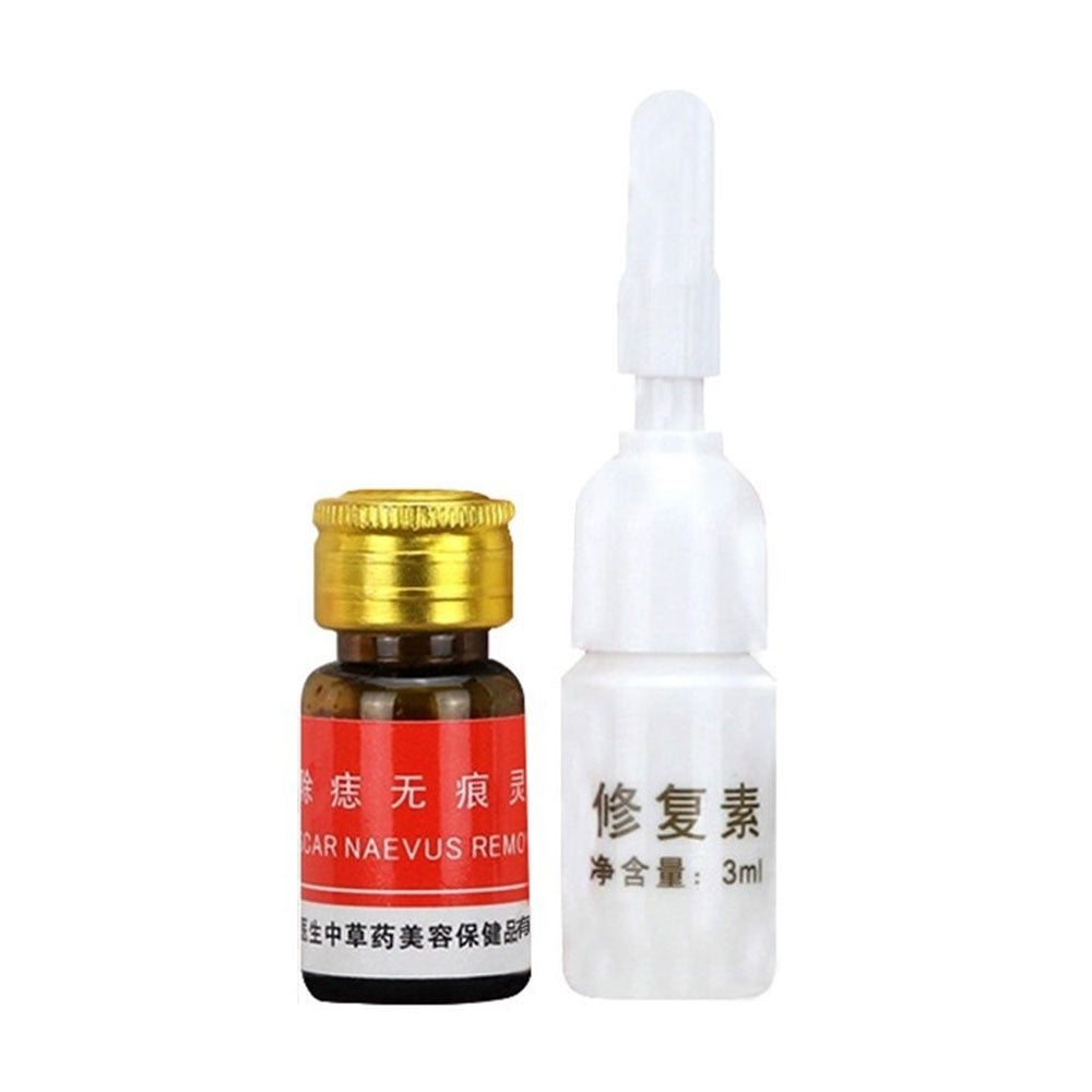 Naevus Mole removal cream