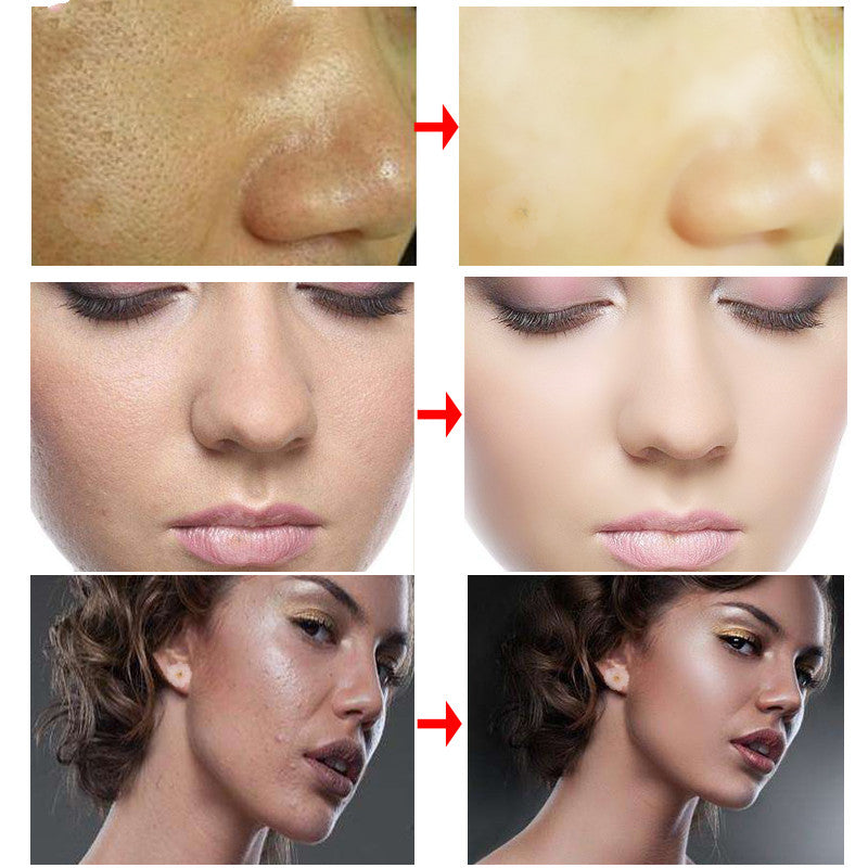RtopR Cream RtopR001