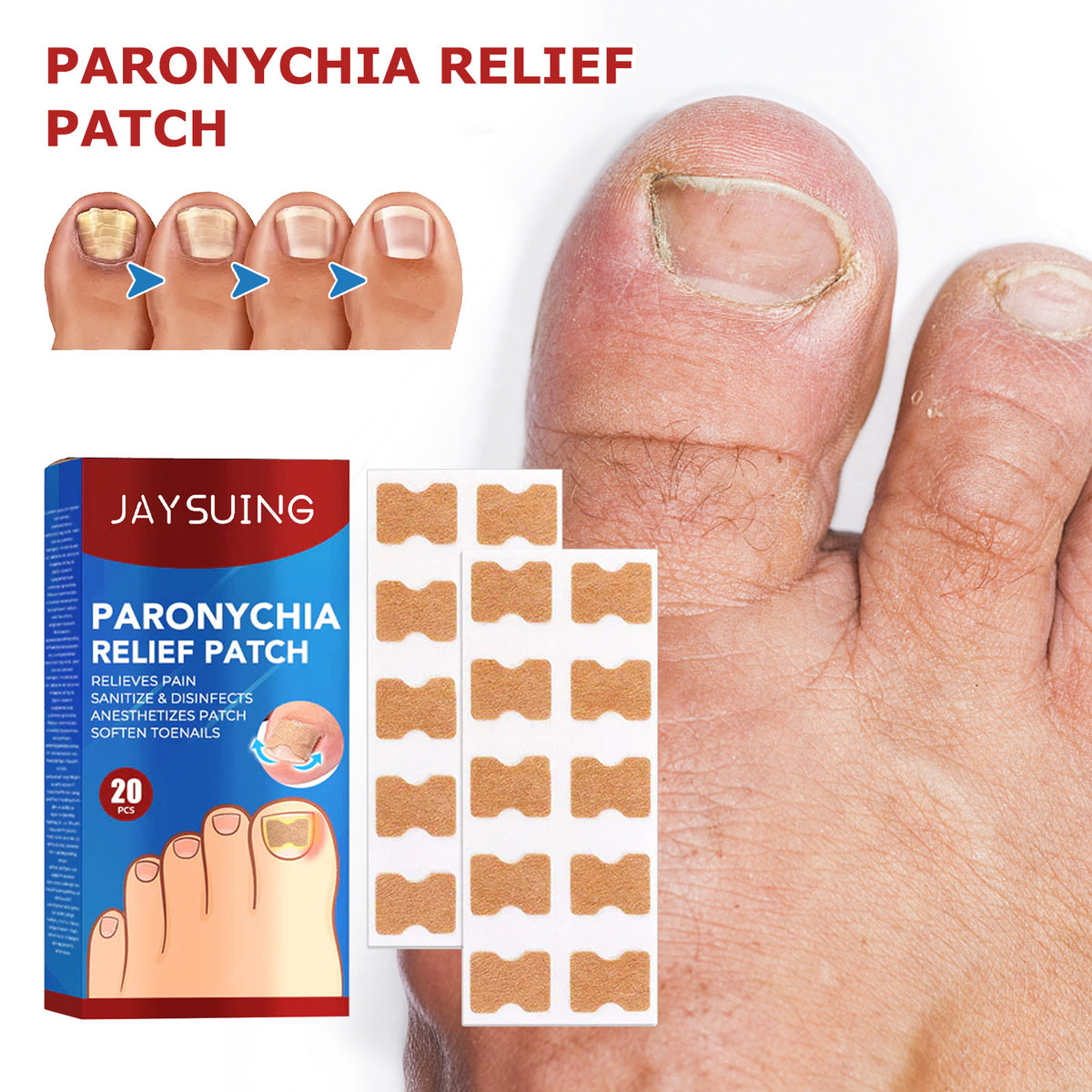 Jaysuing Nail Groove Nursing Adhesive Bandage Nourishing Thickened Gray Nail Soft Nail Correction