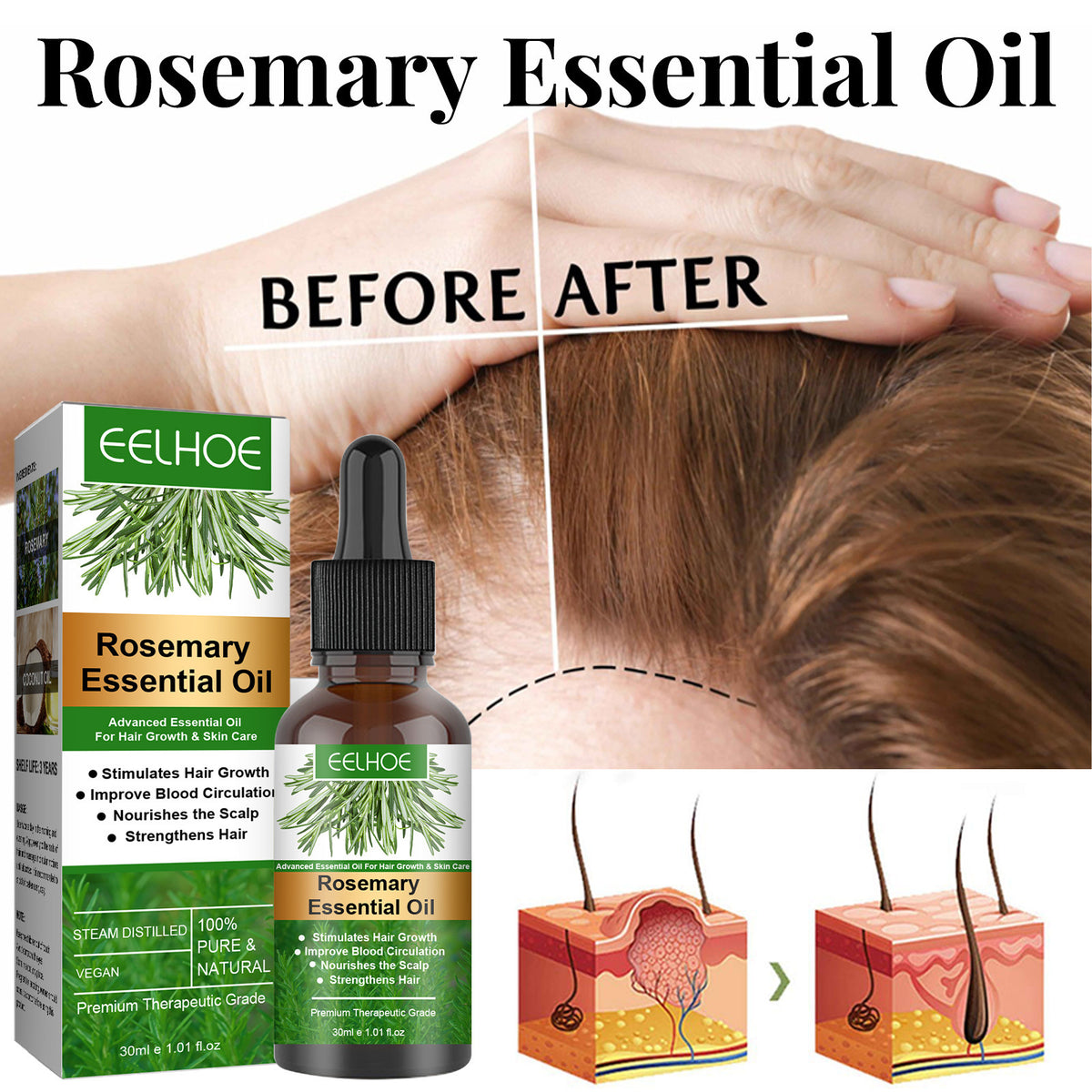 Eelhoe Rosemary Hair Care Essential Oil Anti-loss Hair Growth Hair Care Nourish Scalp Hair Roots